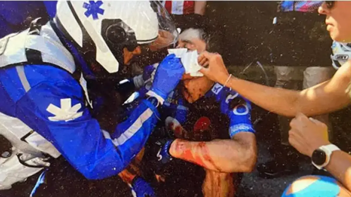 Tour de France 2026 : Einer Rubio abandonne après un violent accident